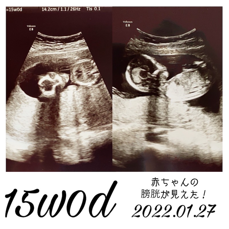 妊娠15週エコー写真