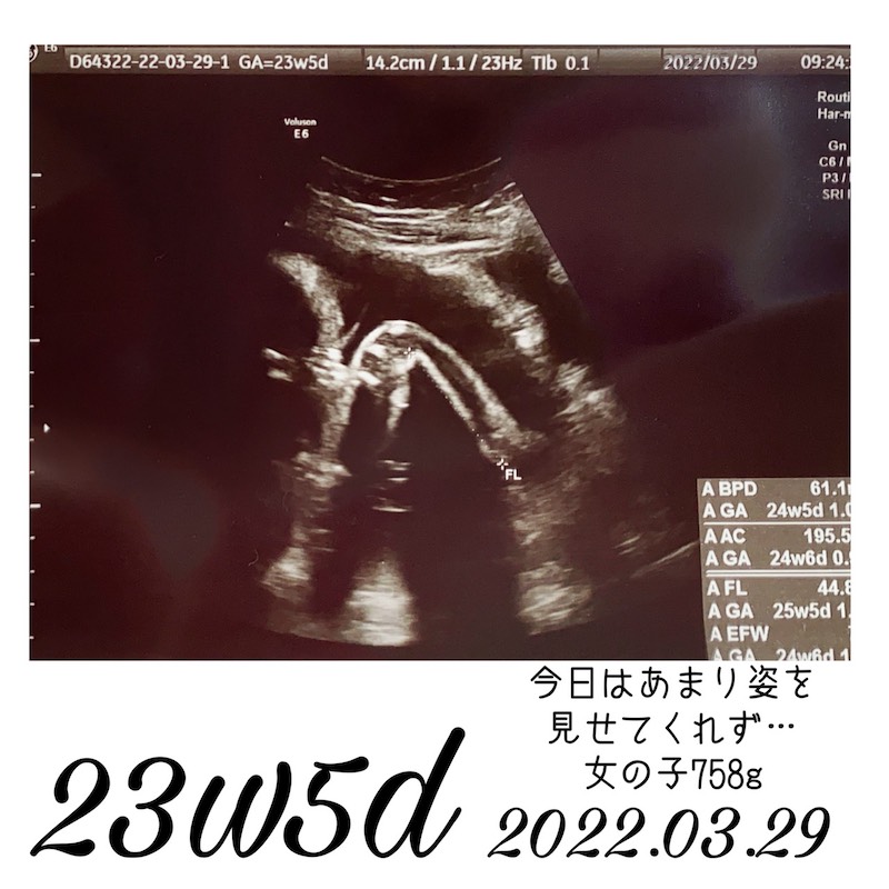 妊娠23週エコー写真1
