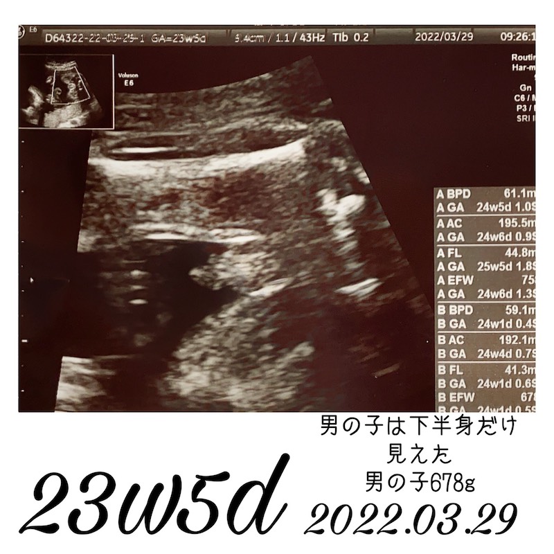妊娠23週エコー写真2
