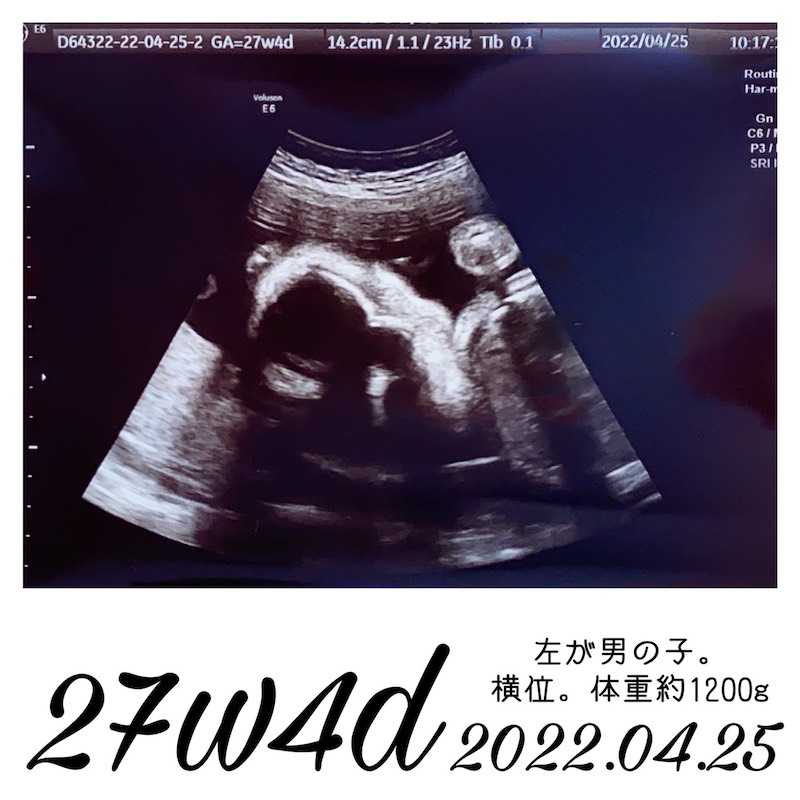 妊娠27週エコー写真2
